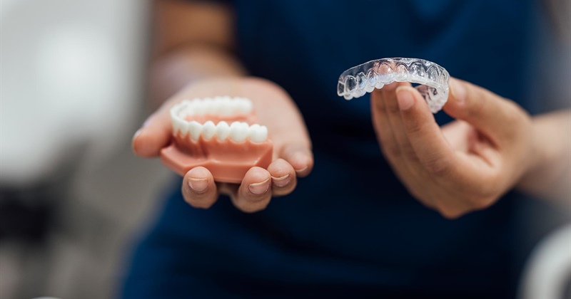 Invisalign für Erwachsene: Preis und Finanzierung