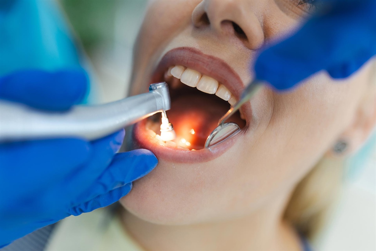 Parodontosebehandlung Ablauf: Was erwartet Patienten?