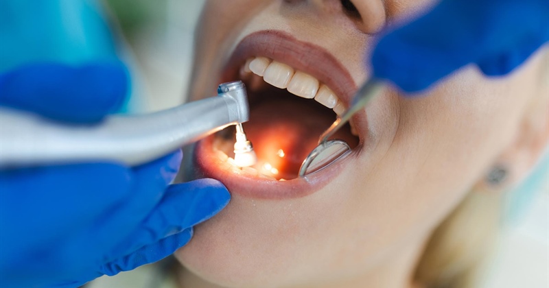 Parodontosebehandlung Ablauf: Was erwartet Patienten?